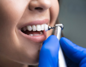 Understanding Root Canal Treatment: Modern Techniques, Patient Comfort, and Clinical Purpose