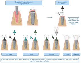 Microbial pioneers: how bacteria shape dental implant health from day one