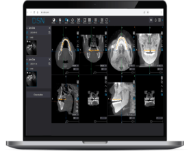 DSN Software Launches the First Cloud-Based Imaging Platform for Dental Specialists