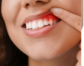 Thorncrest Dental Brings Advanced Laser Dentistry to Etobicoke with Picasso Soft Tissue Laser