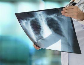 Intelligent Ultrasound Group Agrees to £45M Acquisition by Surgical Science Sweden