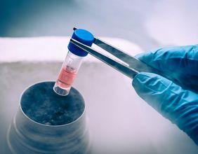 Cash Flow Strength Shapes Market View on Arecor Therapeutics