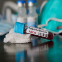 Australia’s Way of Handling and Containing the Coronavirus