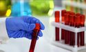 Japanese Patent Office Accepted SUDA’s Anagrelide Cancer Patent Application; Stock Surged Over 10%
