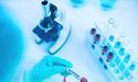 The UK Government Goes in For A Second Contract to Acquire Vaccines for Its Citizens