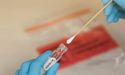 New Zealand on guard, asks Melbourne arrivals to undergo COVID-19 testing