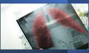 4DMedical (ASX:4DX) commences first clinical pilot in the United States