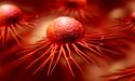 Invion (ASX:IVX) ends March quarter with notable progress in PhotosoftTM technology