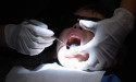  Dental care waiting times drop but are still too high 