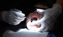 Dental care waiting times drop but are still too high