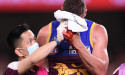 Push for AFL players to get concussion trauma insurance