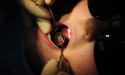  Dental examinations increased 7% in early 2023 
