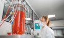 Global Stem Cell Manufacturing Market Size Worth US$ 19.9 Billion by 2028, CAGR 8.1%
