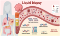 Liquid Biopsy Market Exploration: Emerging Trends and Forecasts | CAGR 20.9%