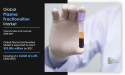 Plasma Fractionation Market Size Envisioning USD $23.006 Billion by 2027, Exclusive Report
