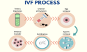Strategic Analysis of the Europe In Vitro Fertilization (IVF) Market 2023: Opportunities and Competitive Landscape