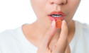 Gadot Biochemical Industries Solves Challenges of Fortifying Gummies with Magnesium