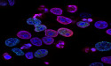 Clinscience and Ryvu Therapeutics sign two Agreements for RVU120