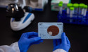 Biomed Diagnostics Fills Public Health Void Following Discontinuation of Popular STI Diagnostic