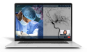 Passage Completes the Design Refresh of Avail Medsystems’ Remote User Interface for its Surgical Telepresence System