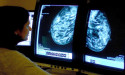  Surgeons perform simultaneous Caesarean and ovary removal to cut cancer risk 