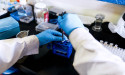 Cytokinetics stock jumped 22% on Thursday: what happened?
