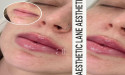Black Rock's Premier Cosmetic Injectables Clinic Aesthetic Lane Launches Innovative Treatments