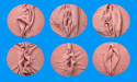 Renowned Cosmetic Surgeon, Dr. Penelope Treece, MD, Sheds Light on the Labiaplasty Procedure