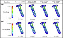  High Tibial Osteotomy (HTO) Plates Market Size Worth USD 398.68 million by 2030 | CAGR of 2.8% 