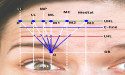 Revolutionizing Aesthetics: Dr. Alhallak's New Technique in Cosmetic Treatment