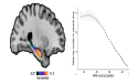 Mapping microscopic pathology of Alzheimer's disease in 3D