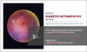  Diabetic Retinopathy Market: Insights, Innovations, and Future Forecasts (2023-2032) 