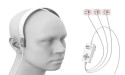Academic Emergency Medicine Publishes Results from EPISODE-PS-COVID Revealing Harmony Can Reliably Identify LVO Stroke