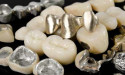  Dental Alloys Market Size Expansion to Drive Significant Revenues in the Future 