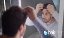  CURA CALVIZIE 2024: arriva l'innovativo metodo hCRP Sonicato proposto da HairClinic 
