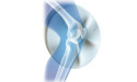 Unlock Restorative Sleep: knēNest Unveils Groundbreaking AI-Optimized Knee Pillow for Side Sleepers