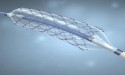 Alfa Chemistry Debuts Shape Memory Alloys, Nitinol SMAs, and 3D Printing Alloys