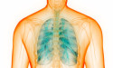 Alpha 1 Lung Disease Market Recent Trends and Developments Analysis | Scope of Current and Future Industry 2031|