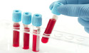 Blood Coagulation Tubes Market 2031| with Future Prospects, and Key Player Medical Expo, Ajosha BioTeklik.