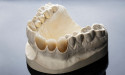  Durability and Longevity of Ceramic Crowns: What Patients Need to Know 