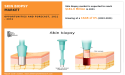 Skin Biopsy Market to Achieve $181.6 Million by 2031 | CAGR of 6% Globally