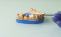  Latin America’s Dental Prosthetics Market Favors Ceramics and CAD/CAM Technology, Growing to Exceed $17B by 2030 
