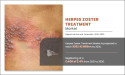 Herpes Zoster Treatment Market Updates : to Surpass USD 303.42 Mn, Globally, by 2030 at 3.4% CAGR