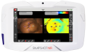 SnapshotNIR Used to Predict Skin Flap Necrosis Intra-Operatively in Oncologic Resection Reconstruction