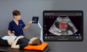 Clarius Takes the Lead in the AI Ultrasound Innovation Race with the Introduction of Clarius OB AI