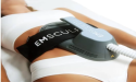  New EMSCUPLT “Beach Body Ready” Service to be launched in Hampton Roads and Williamsburg From D and S Wellness 