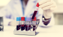 Why are Mustang Bio shares (MBIO) up almost 500%?