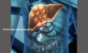 Biomed Presents NA-931 and NA-941 for Treatment of Obesity and MASH at ADA Conference and Global MASLD Congress 2024