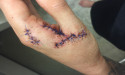 Santa Monica Pays $3 Million To Two Women Severely Injured When An Officer Cut Their Hands With A Knife And Scissors