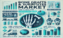 Global Bone Grafts and Substitutes Market Set for Significant Growth, Expected to Reach USD 6.3 Billion by 2032 | FMI